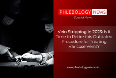Vein Stripping in 2023: Is it Time to Retire this Outdated Procedure for Treating Varicose Veins?
