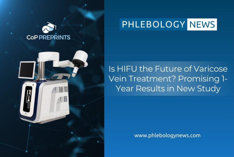 Is HIFU the Future of Varicose Vein Treatment? Promising 1-Year Results in New Study