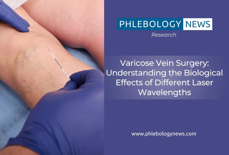 Varicose Vein Surgery: Understanding the Biological Effects of Different Laser Wavelengths