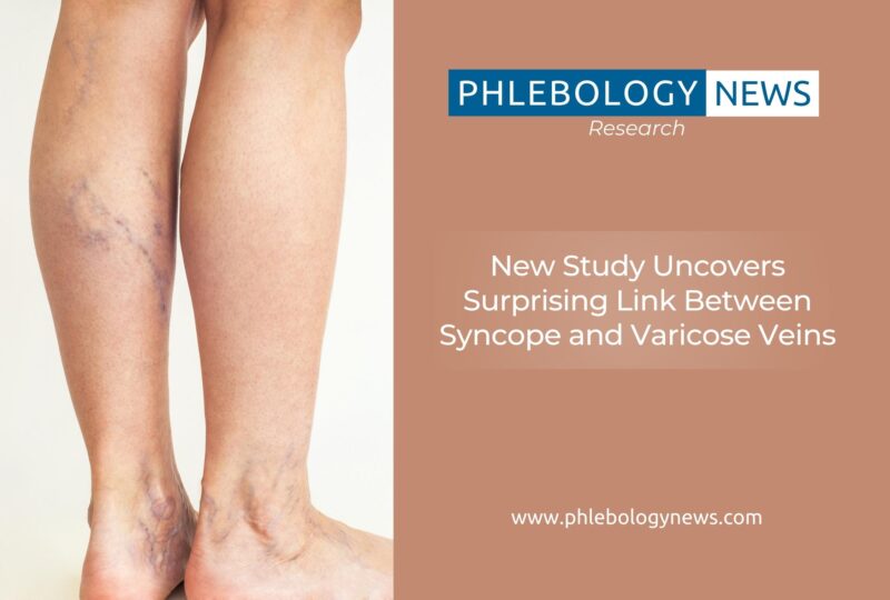 Phlebology News: New Study Uncovers Surprising Link Between Syncope and Varicose Veins