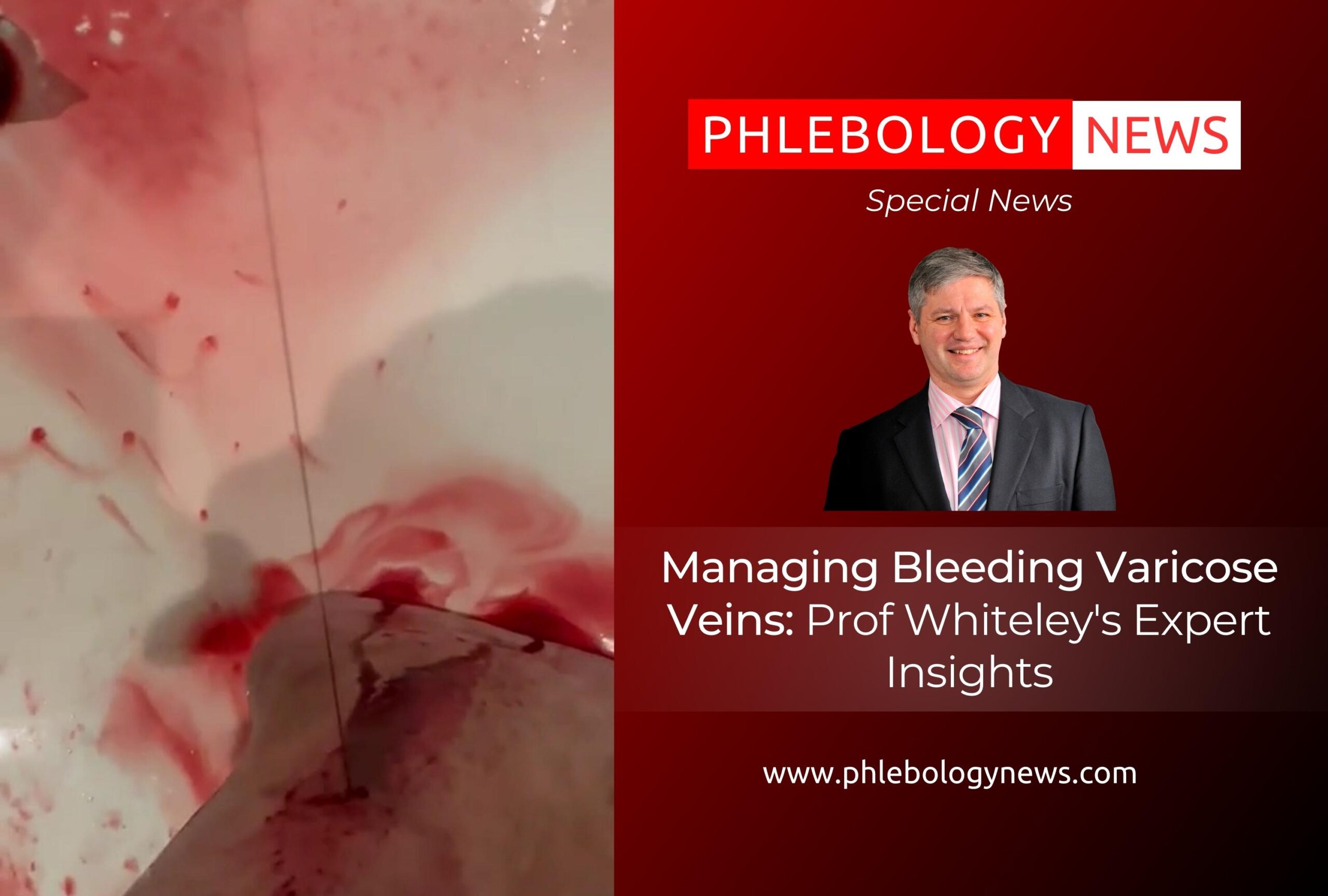 Bleeding Face?  Expert Advice For Fast Relief - d97bu9s