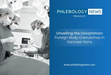 Unveiling the Uncommon: Foreign Body Granulomas in Varicose Veins