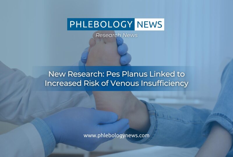 New Research: Pes Planus Linked to Increased Risk of Venous Insufficiency