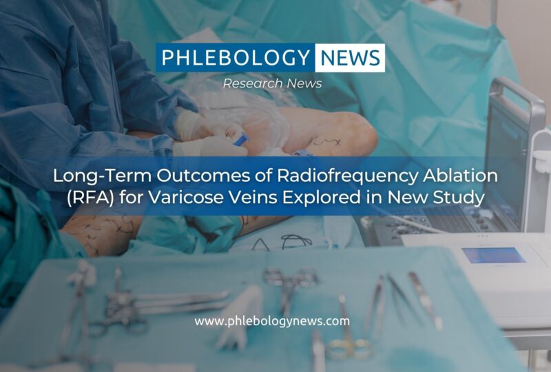 Long-Term Outcomes of Radiofrequency Ablation (RFA) for Varicose Veins Explored in New Study