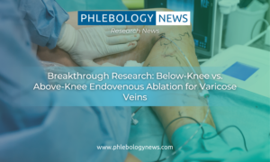 Breakthrough Research: Below-Knee vs. Above-Knee Endovenous Ablation for Varicose Veins